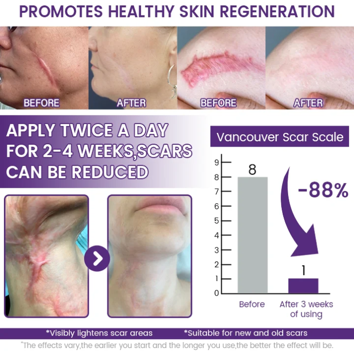 Regenscar Gel Reparador de Cicatrices